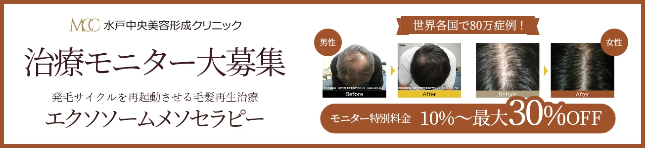 治療モニター大募集 発毛サイクルを再起動させる毛髪再生治療エクソソームメソセラピー